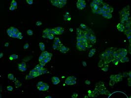IHC-plus™ ATP5B / ATP Synthase Beta Antibody (clone 5G2)