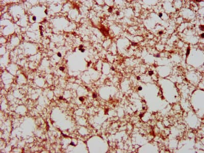Polyclonal Rabbit anti-Human PAK4 Antibody (IHC)