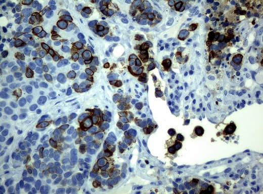 KRT19 / CK19 / Cytokeratin 19 Antibody (aa240-390, clone UMAB2)