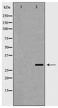 HOXB5 Antibody