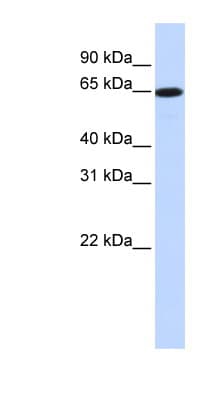 Polyclonal Rabbit anti-Human SLC43A1 Antibody (aa324-373, WB)