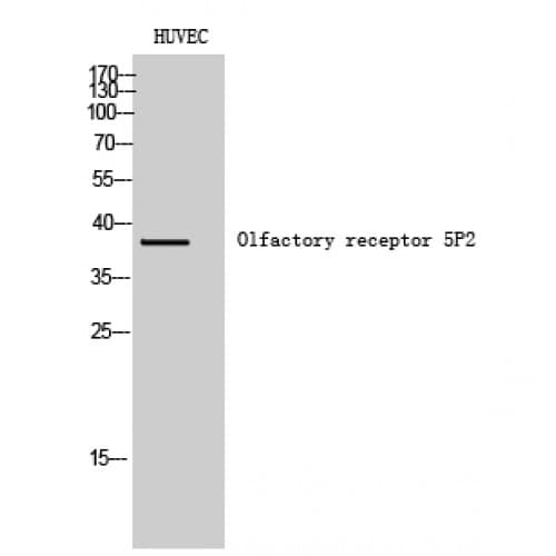 Polyclonal Rabbit anti-Human OR5P2 Antibody (170-250 aa, Internal, IF, WB)