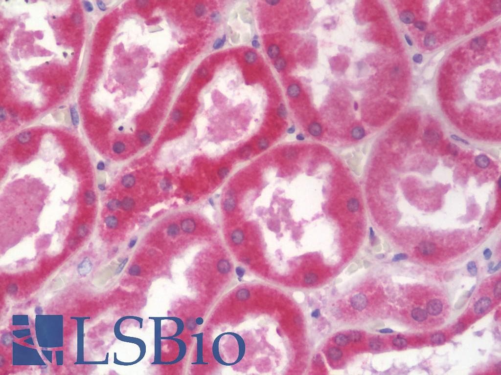 IHC-plus™ ALDH3A2 Antibody (aa166-400)