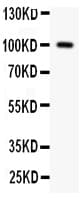 F2 / Prothrombin / Thrombin Antibody (aa600-612)