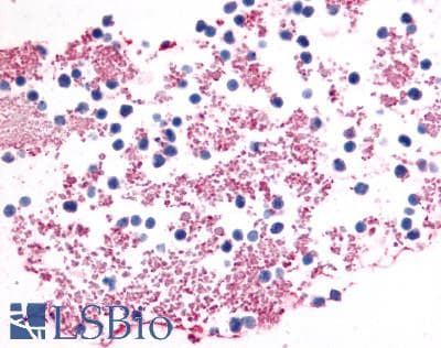 PathPlus™ Polyclonal Rabbit anti-Human P2RY12 / P2Y12 Antibody (N-Terminus, IHC)