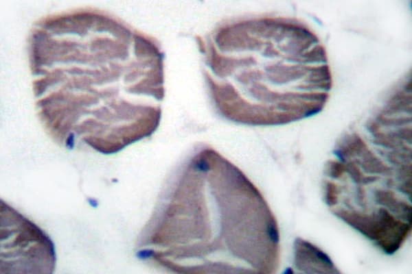 ACTA3 / ACTG2 Antibody (Glu2)