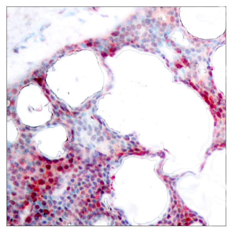 ATF2 Antibody (phospho-Ser62)