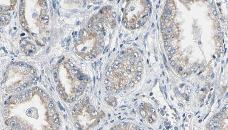 NAT1 / AAC1 Antibody