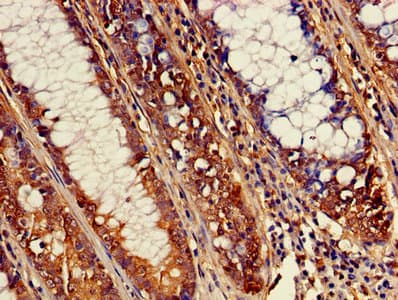 Polyclonal Rabbit anti-Human ATP1B3 Antibody