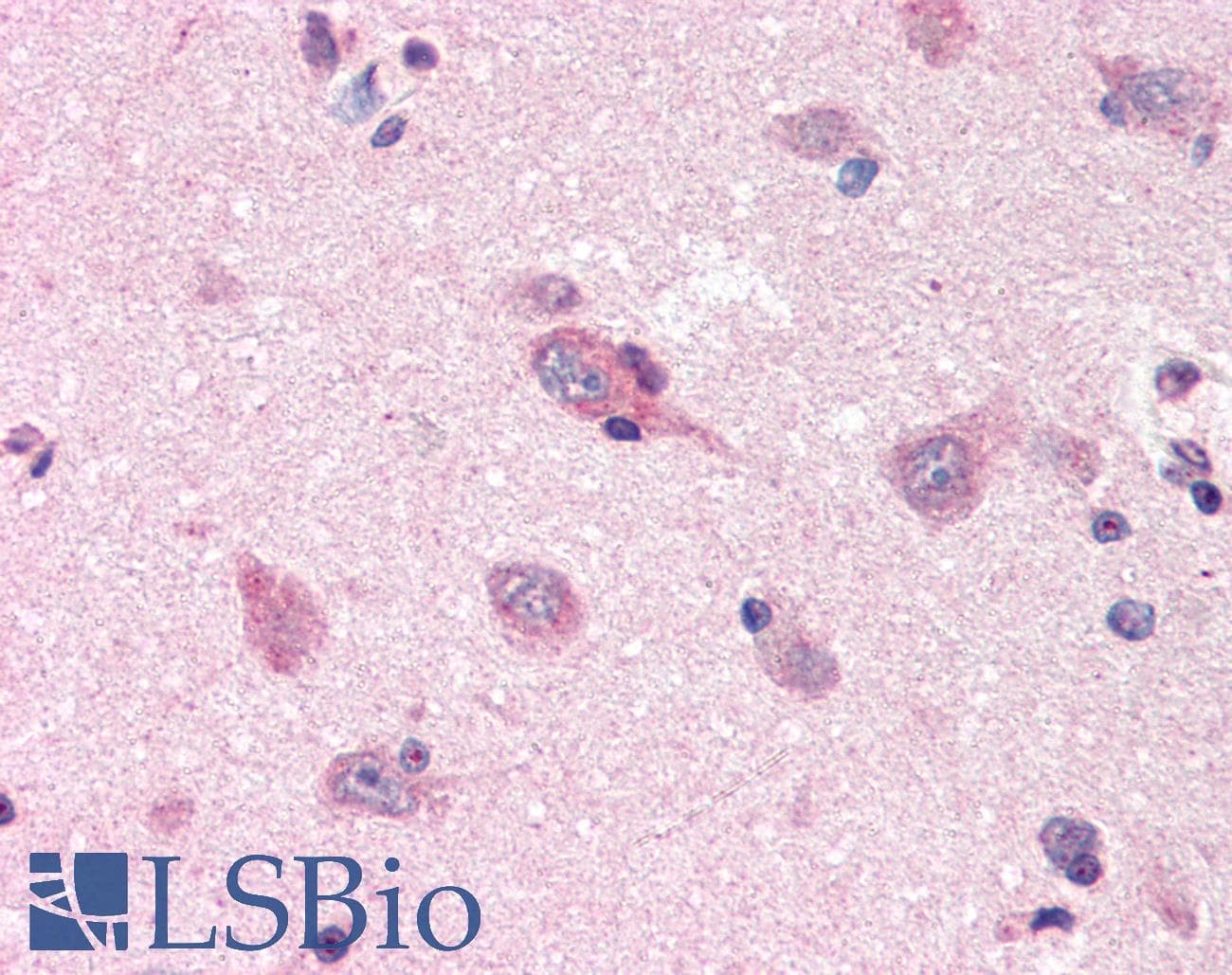 IHC-plus™ APP / Beta Amyloid Precursor Antibody (aa18-289, clone J4H9)