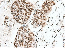 NOTCH1 Antibody (clone OTI3E12)