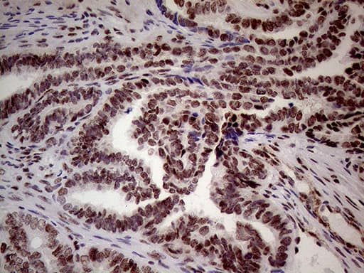 NSD3 / WHSC1L1 Antibody (aa427-566, clone OTI3B3, Carrier-free)