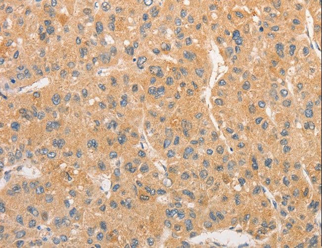 TLR3 Antibody