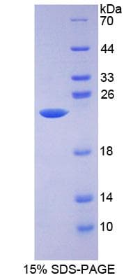 Mouse ALDH9A1 Protein (Recombinant His-S)