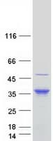 Human ERP27 Protein (Recombinant Myc-DDK (Flag))
