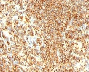 CD20 Antibody (clone IGEL/773, Ready-to-Use)