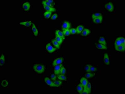 SLC11A2 / DMT1 Antibody