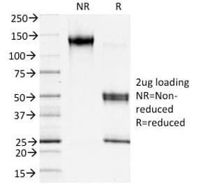 S100A4 / FSP1 Antibody (clone S100A4/1481)