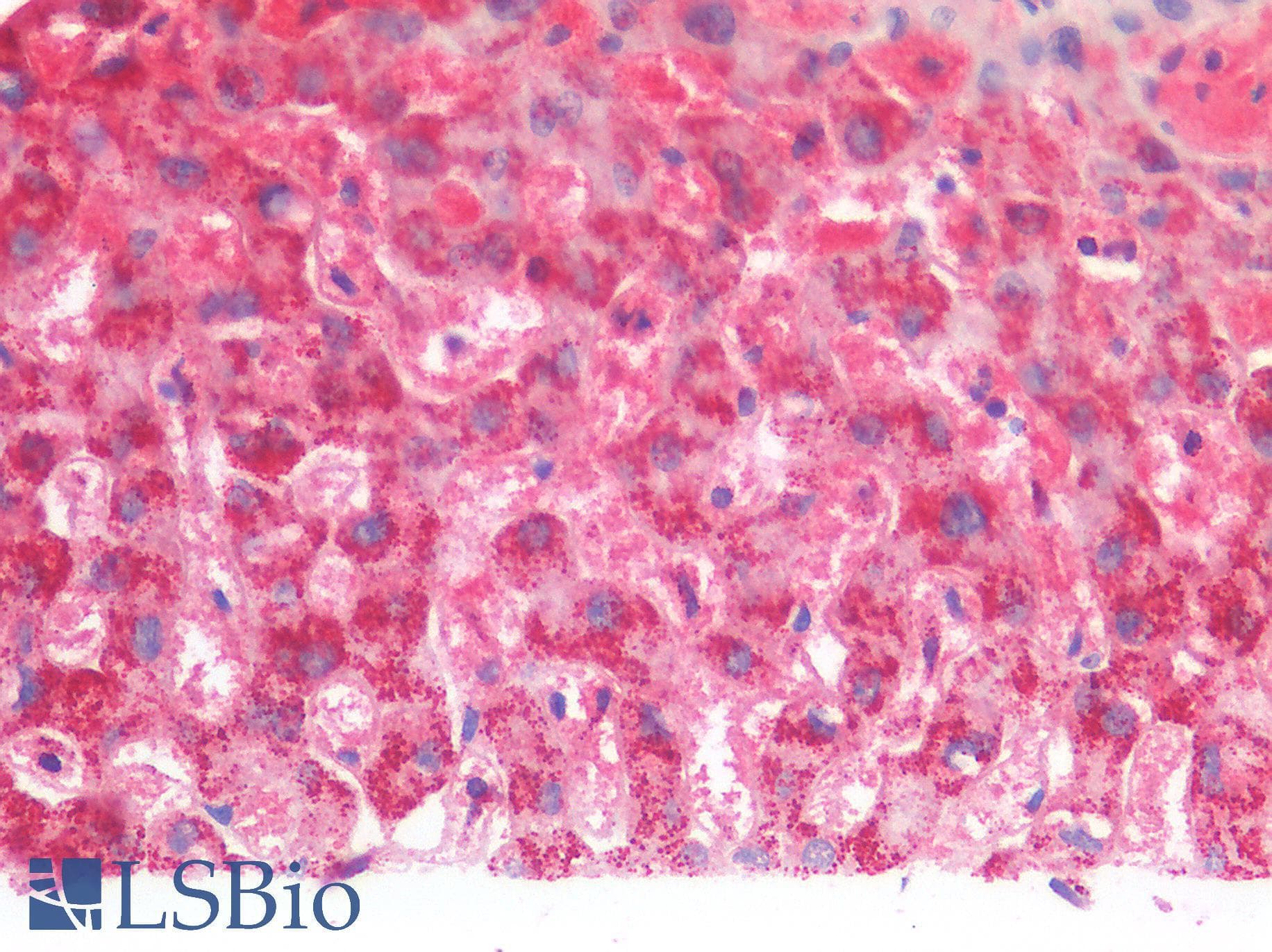 IHC-plus™ Polyclonal Goat anti-Human MDH / MDH2 Antibody (Internal Region, IHC, WB)