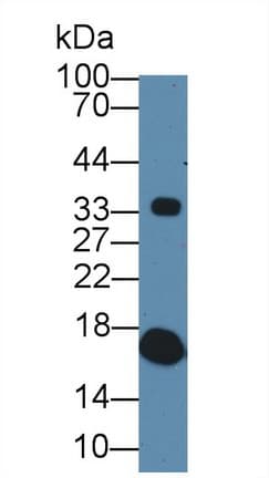 TTR / Transthyretin Antibody (aa21-150)