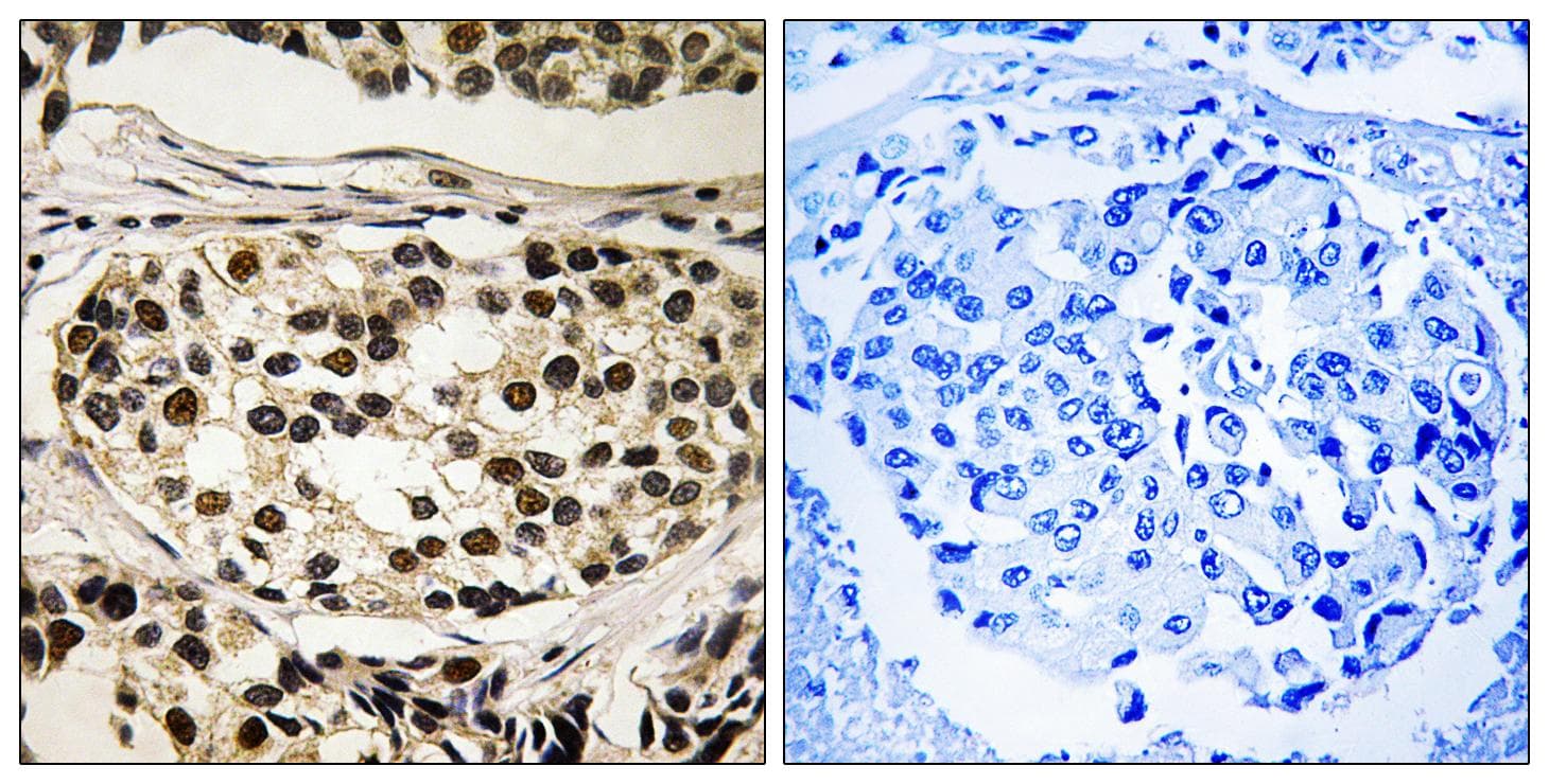 Polyclonal Rabbit anti-Human CCNC / Cyclin C Antibody (phospho-Ser275, IHC, WB)