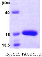 Human MYDGF / SF20 Protein (Recombinant His)