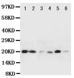 HSPB2 / HSP27 Antibody (aa102-118)