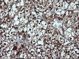Monoclonal Mouse anti-Human LGALS3 / Galectin 3 Antibody (clone 1G8, Carrier-free, IHC, IF, WB)