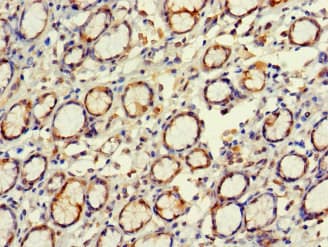 EXD2 Antibody