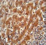 Polyclonal Rabbit anti-Human PKM / Pyruvate Kinase, Muscle Antibody (aa476-505, IHC, IF, WB)