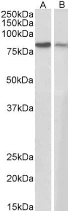 IHC-plus™ JUP/CTNNG/Junction Plakoglobin Antibody (aa732-745)