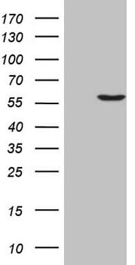 MLR2 / LCOR Antibody (aa204-433, clone OTI2A9)