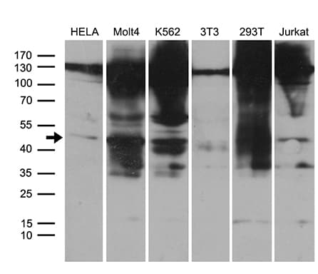 HDAC8 Antibody (aa1-243, clone OTI1A4, Carrier-free)