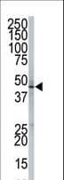 PIGK Antibody (aa37-68)