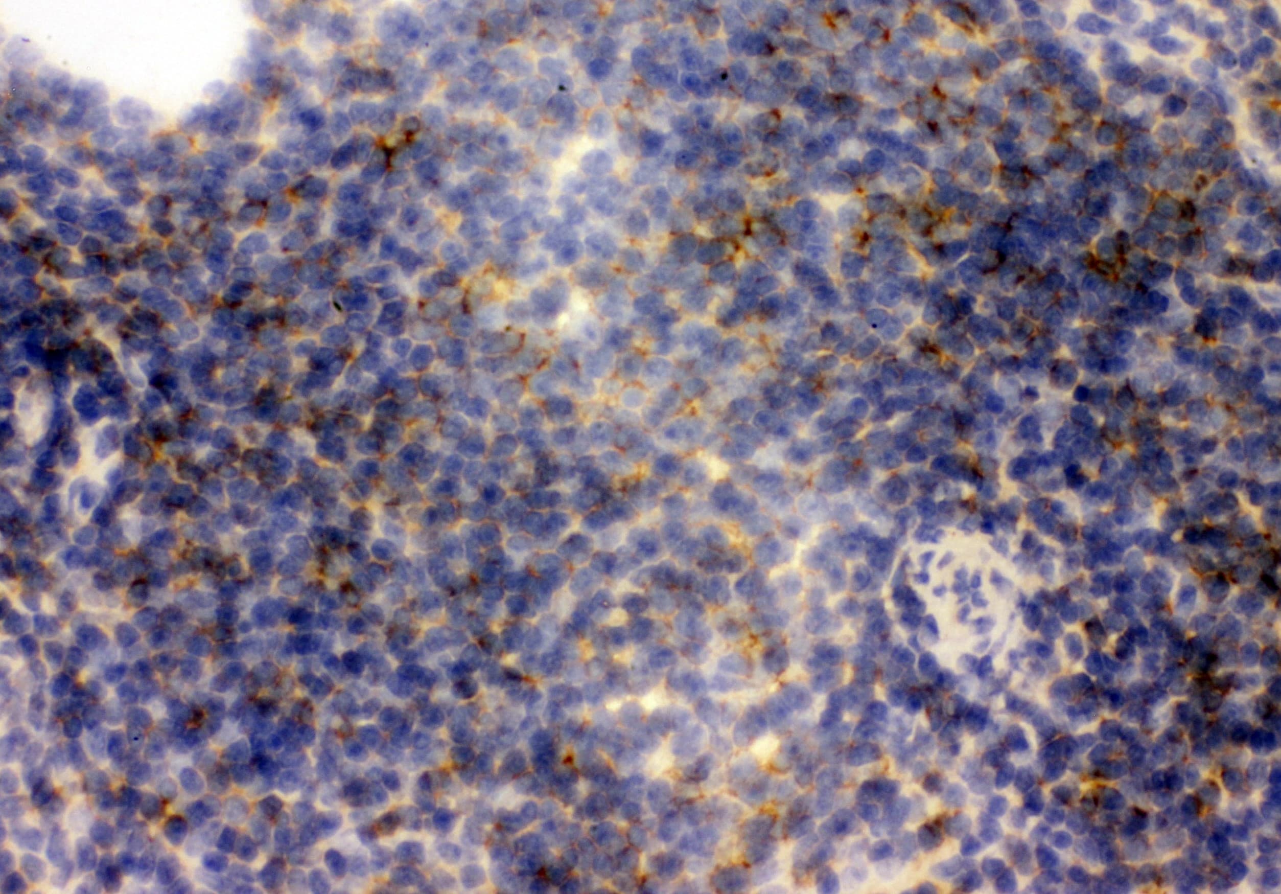 FCER2 / CD23 Antibody (aa50-331)