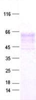 Human SERPINB4 / SCCA1+2 Protein (Recombinant His, N-Terminal)
