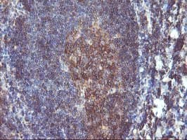 DSTN / Destrin Antibody (clone OTI1G8, Carrier-free)