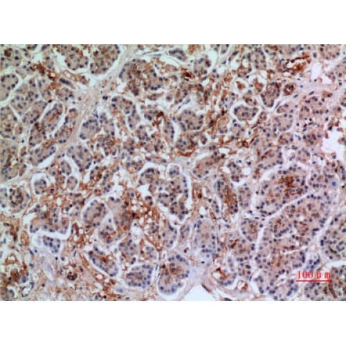 ANXA7 / Annexin VII / SNX Antibody (271-320 aa, Internal)