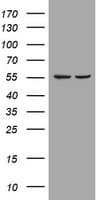 PIK3CD / PI3K Delta Antibody (aa286-610, clone OTI2D9)