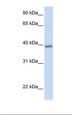 Polyclonal Rabbit anti-Human OCSP / TSPAN10 Antibody (Biotin, aa74-123, WB)