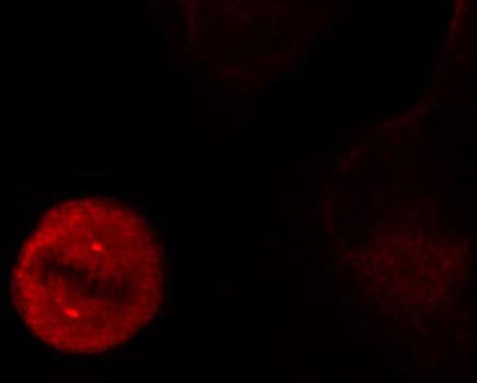 Polyclonal Rabbit anti-Human MAPK3 / ERK1 Antibody (phospho-Tyr204, IHC, IF, WB)