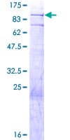 Human BMP2K / BIKE Protein (Recombinant GST)