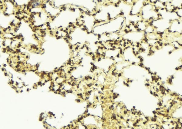 SREBF1 / SREBP-1 Antibody