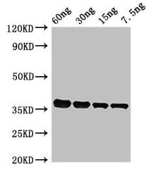 Putative L-asparaginase Antibody