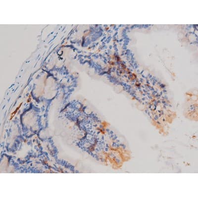 CDC25A Antibody (phospho-Ser75)