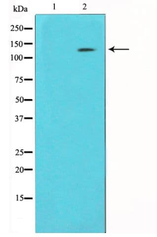 EGFR Antibody (phospho-Ser1070)