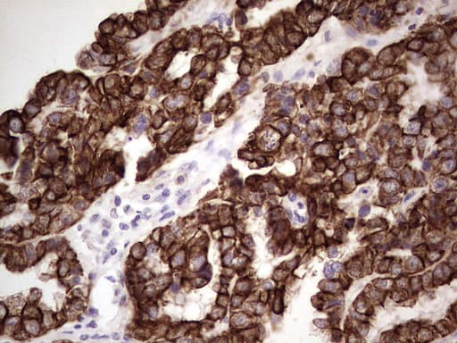 KRT19 / CK19 / Cytokeratin 19 Antibody (aa240-390, clone OTI5B11)