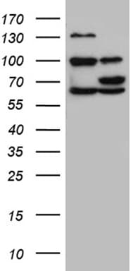 GNPAT / DHAP-AT Antibody (clone OTI1H1)