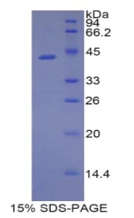 Rat LCN9 Protein (Recombinant His-GST)