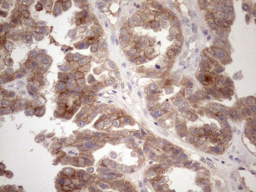 c-Met Antibody (aa570-885, clone UMAB190)